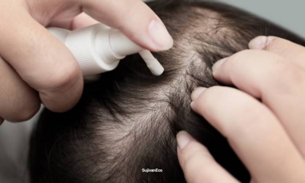 Dandruff Se Chutkara Paane Ke 5 Natural Gharelu Nuskhe